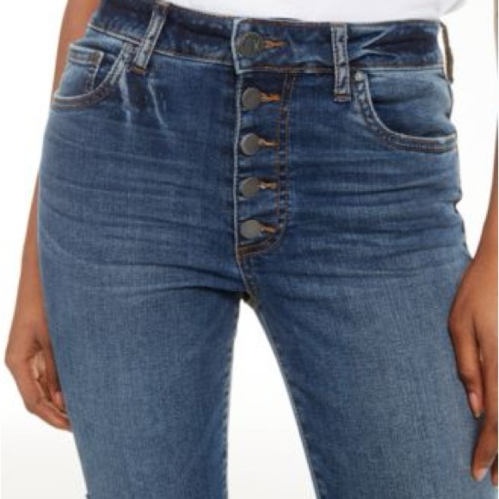 Kut from the Kloth Button-Fly Skinny Jeans